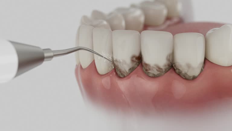 Reliable Tooth Extraction contractor in McCreary County County, KY by Dentist Open Now